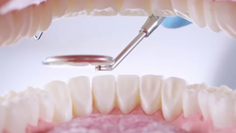 Dentist inspects teeth with probe and mirror Stock Footage 139636957