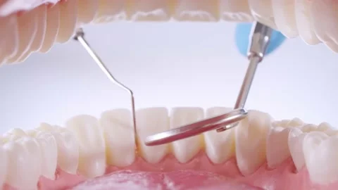 Dentist inspects teeth with probe and mirror Stock Footage 139637382