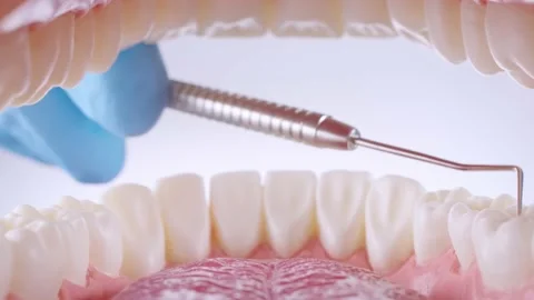 Dentist inspects teeth with probe Stock Footage 139637038