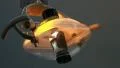 Dentist lamp (tilt shot) HD Footage