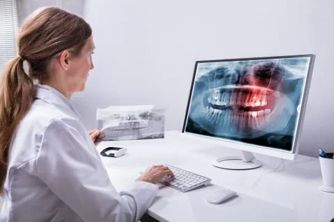 Dentist Looking At Teeth X-ray On Computer Stock-Fotos