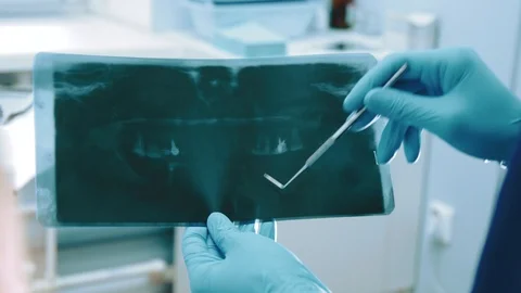 Dentist looking at x-ray of teeth Stock Footage 91906231