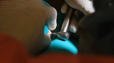 Dentist machine Stock Footage 34273845