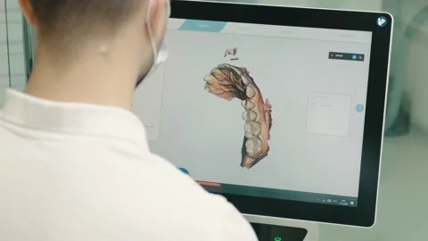 The dentist makes a 3D model of the patient's jaw close-up on the monitor. Stock Footage 147739830