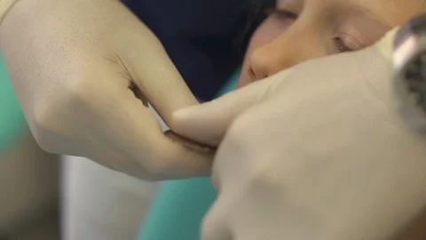 Dentist makes a bite cast in a child Stock Footage 115910086