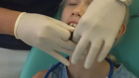 Dentist makes a bite cast in a child Stock Footage 115910150
