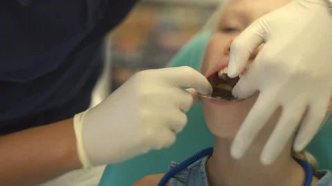Dentist makes a bite cast in a child Stock Footage 115910180