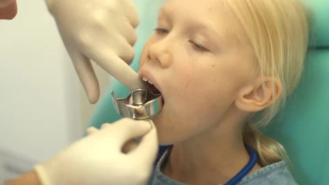 Dentist makes a bite cast in a child Stock Footage 115910192