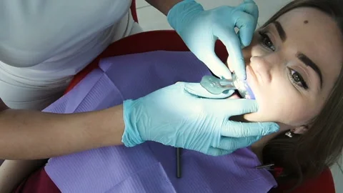 Dentist makes a cast of teeth for prosthetics 動画素材 103752962