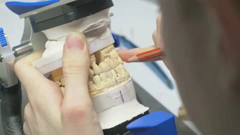 The dentist makes marks on the bite, denture, artificial jaw, denture, hands Stock Footage 147739762