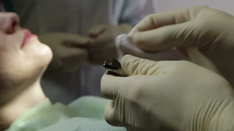 Dentist makes a mold of teeth Video stock 61851675