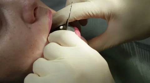 Dentist makes a mold of teeth Stock Footage 61851742
