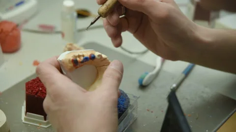 The dentist makes a mold of the teeth Stock-Footage 101441576