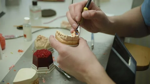 The dentist makes a mold of the teeth Stock Footage 103755025