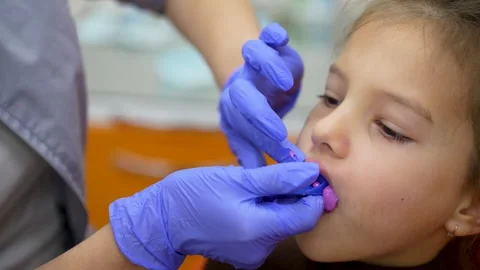 Dentist making a jaw shape to take an impression of the child patient teeth.. Stock Footage 285214493