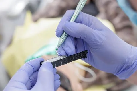 Dentist measuring endodontic file before root canal treatment Stock Photos