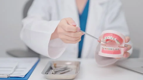 Dentist with Orthodontic tooth model and bracket or brace. Clean and Scrape.. Stock Footage 337919725
