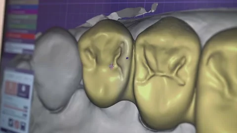 Dentist orthopedist modelling on the computer teeth crowns implants Stock Footage 232602718