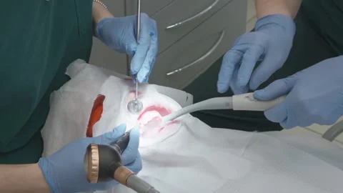 Dentist performing air flow plaque removal with assistant using suction Video stock 332300035