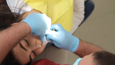 The dentist performs teeth whitening using modern methods. Vertical video Stock Footage 250131227