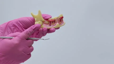 Dentist in Pink Gloves Explaining Tooth Anatomy on Jaw Model Stock Footage 333550353