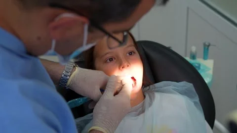 Dentist placing composite filling material into little girl tooth cavity cl.. Vídeo Stock 339076891
