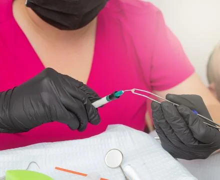 Dentist placing glue on bracket Foto stock
