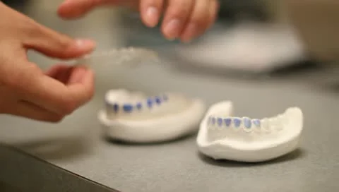 Dentist placing retainers on plaster teeth Stock Footage 10708745
