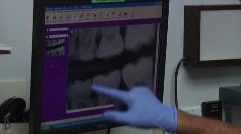 Dentist pointing at teeth on X-ray Stock Footage 8916514