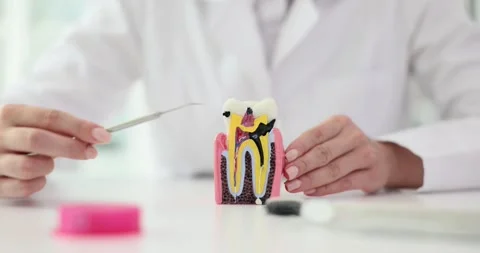 Dentist points at anatomical model of tooth with caries at desk Stock Footage 310212765