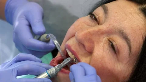 Dentist polishes client's upper teeth Stock Footage 311945668
