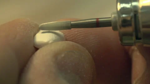 Dentist polishing denture implants in laboratory in slow motion. Close Up. Stock Footage 48921457
