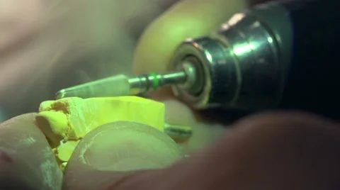 Dentist polishing denture implants in laboratory in slow motion. Close Up. Stock-Footage 48921562