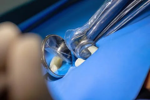 Dentist positioning curing light during root canal treatment Stock Photos