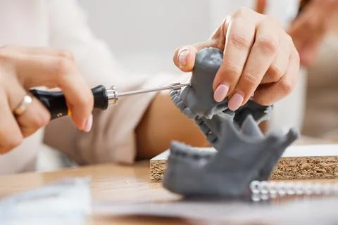 Dentist practice with mini screw model on dental model. Orthodontic dentistry Stock Photos