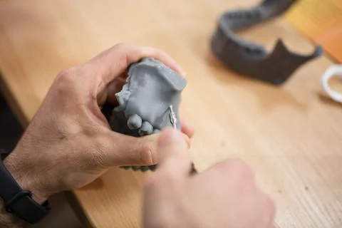 Dentist practice with mini screw model on dental model. Orthodontic dentistry Stock Photos