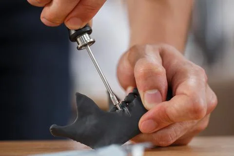 Dentist practice with mini screw model on dental model. Orthodontic dentistry Stock Photos