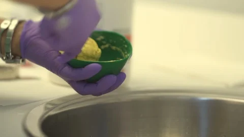 The dentist is preparing to make a cast of teeth for braces Stock Footage 116181899