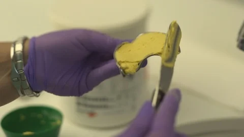The dentist is preparing to make a cast of teeth for braces Stock Footage 116182062