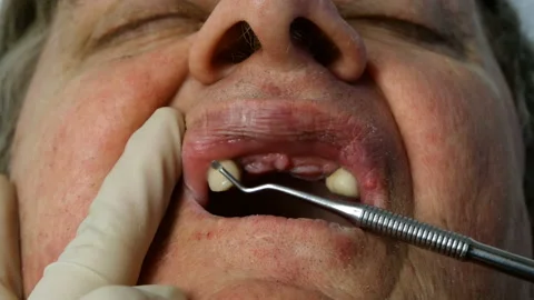 Dentist in protective surgical gloves. Stock Footage 130415568