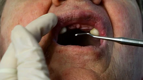 Dentist in protective surgical gloves. Stock Footage 131947904