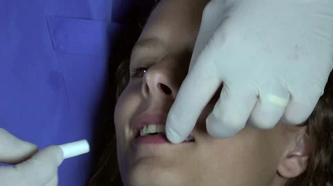 Dentist put cotton rolls Video stock 53005807