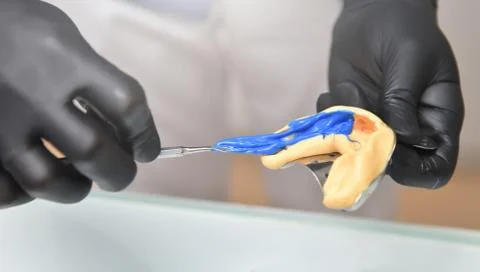 The dentist puts a silicone paste to create the imprint of the teeth Stock Photos