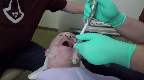 Dentist removes decayed tooth from man patient HD Stock Footage 68953005
