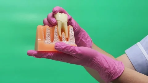Dentist Removing and Replacing Molar Tooth in Jaw Model on Green Screen Stock Footage 337106537