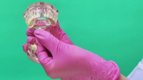 Dentist Removing and Replacing Two Front Implant Crowns on Transparent Jaw Model Stock Footage 337106361