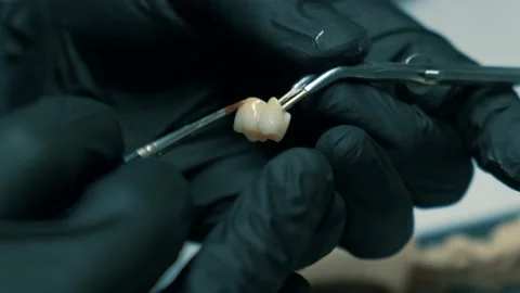 Dentist selects the color of the tooth, denture, artificial tooth, denture Stock Footage 147739744