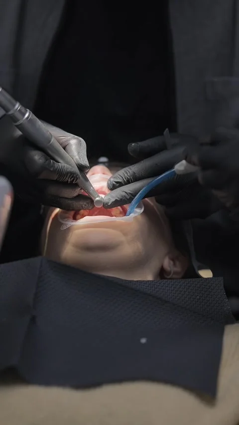 Dentist shaping teeth for crown placement with dental handpiece. Prosthetic Stock Footage 341704874