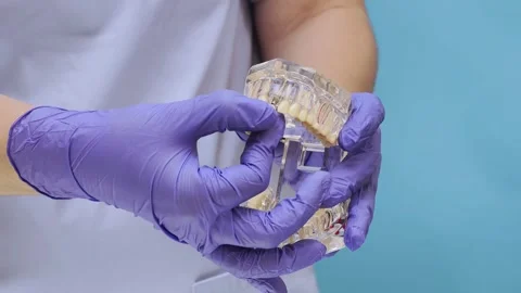 Dentist showing transparent jaw model with missing tooth and implant placement Stock Footage 332164367
