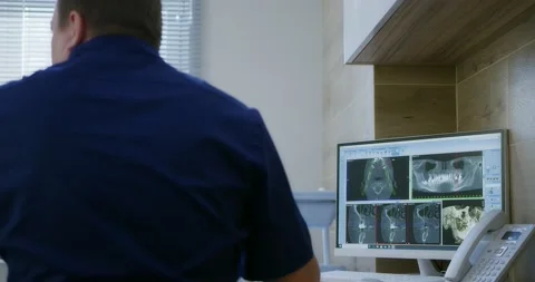 The dentist shows x-rays of the teeth on the monitor in the dentist's office. Stock Footage 166823066